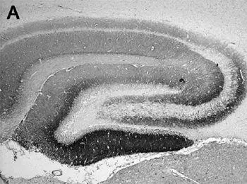 A Section of rat brain in the hippocampus that shows the reactivity of the - фото 49