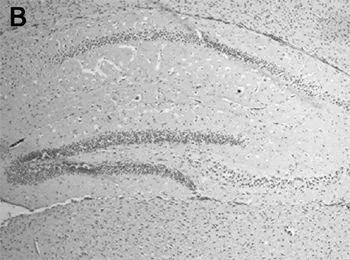 B A similar section of hippocampus of an individual without NMDA receptor - фото 50