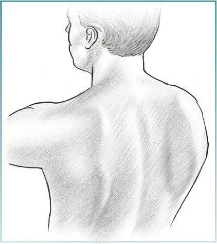 Scapular Dip Execution 1 Sitting upright between two 6inch 15 cm - фото 80