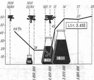 Рис 43Больной 34 лет Кровоточащая язва двенадцатиперстной кишки Еще один - фото 63