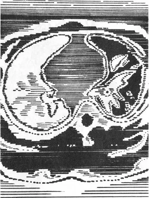 Голем 100 - фото 116