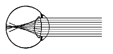 Figure A22 Phenomenon of Spherical Aberration 2 The phenomenon of light - фото 27