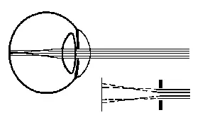 Figure A23 Phenomenon of Diffraction of Light on the Pupil b The operation - фото 28