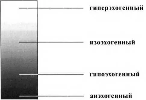 Рисунок 6 Виды эхогенности при ультразвуковом исследовании щитовидной железы - фото 15