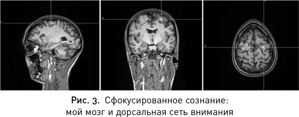 Я предположила что планируется подтолкнуть мой мозг к тому чтобы он работал - фото 4