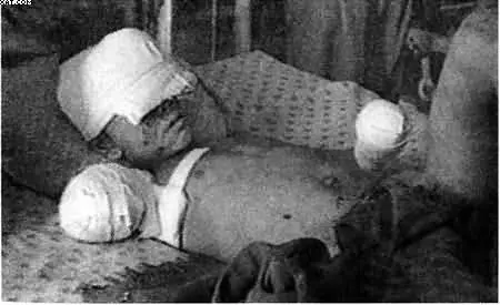 14летний мальчик получивший увечья под Джелалабадом в результате американских - фото 43