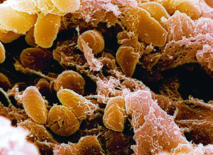The real culprit was the minuscule Yersinia pestis bacterium - фото 3