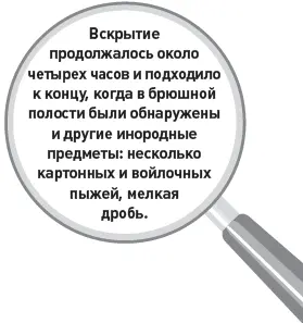 Вскрытие продолжалось около четырех часов и подходило к концу когда в брюшной - фото 11