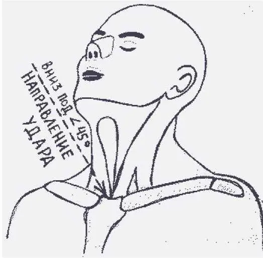 рисунок 50в Верхняя часть головы Макушка и лобные швы Анатомическое - фото 116