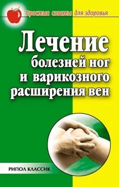 Евгения Сбитнева Лечение болезней ног и варикозного расширения вен обложка книги