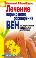 Екатерина Андреева - Лечение варикозного расширения вен проверенными народными рецептами