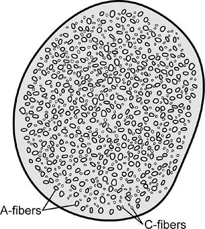 Figure 31Crosssection of the sural nerve Normal human nerve like that - фото 44