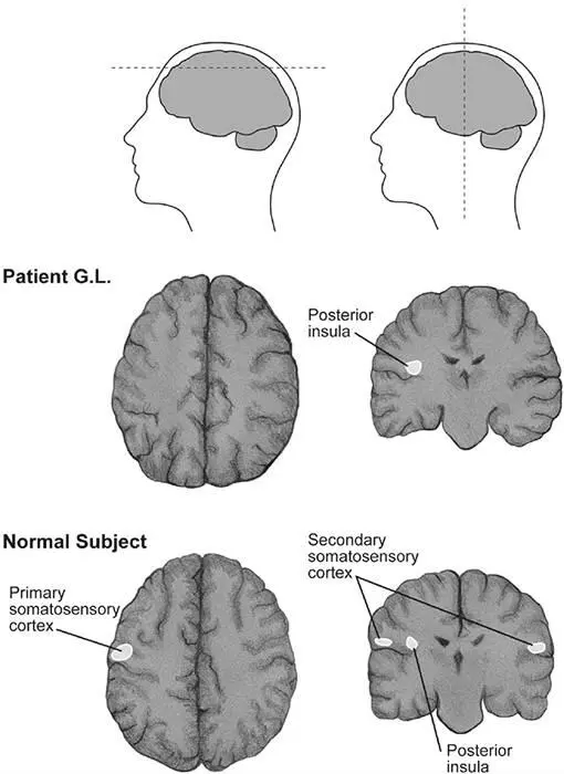 Figure 33A light caress on the right forearm activates the left anterior - фото 47