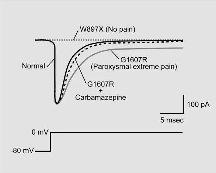 Figure 61Mutations of the SCN9A gene can produce dramatic alterations of pain - фото 81