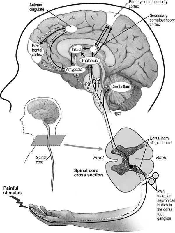 Figure 64Two major pathways conveying pain information to the brain The fast - фото 85
