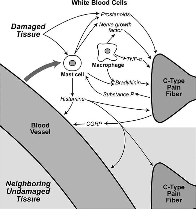 Figure 65Tissue damage results in production of an inflammatory soup of - фото 88
