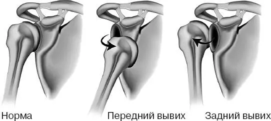 Ознакомьтесь с таблицей в которой указаны характерные признаки повреждений и - фото 60