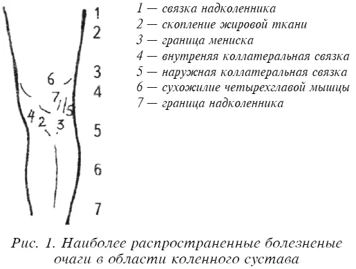 1 основные приемы - фото 138