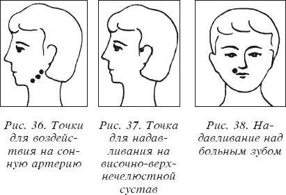 надавите на место проекции височноверхнечелюстного сустава рис 37 - фото 288