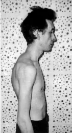 Рис 66 Грудной кифоз При кифотическом искривлении уменьшается дыхательный - фото 78