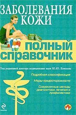 Коллектив Авторов Заболевания кожи обложка книги