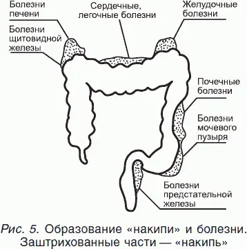 Если данный участок забит накипью каловыми камнями то стимуляции нет и - фото 5