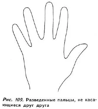 Иногда на базовой фаланге расположенной ближе всего к ладони можно заметить - фото 104