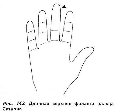 Если средняя фаланга является самой длинной из трех рис 143 это указывает - фото 137