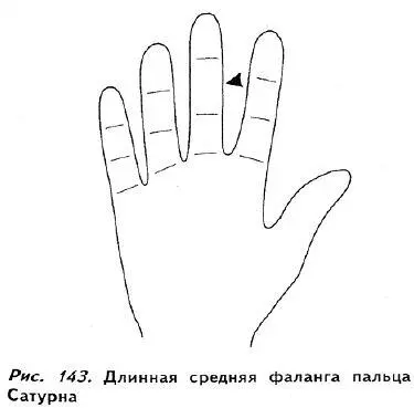 Если средняя фаланга очень короткая по сравнению с двумя остальными рис 144 - фото 138