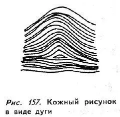 Петли чаще всего встречаются на руках европейцев Люди с кожным рисунком в виде - фото 152