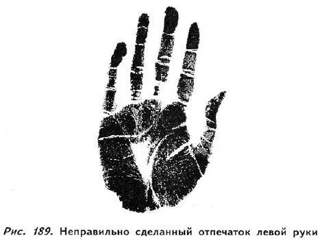 В подобных случаях я прошу человека слегка приподнять руки после чего - фото 183