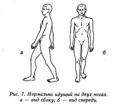 Если же туловище согнуто и наклонено то движения нарушаются походка - фото 7