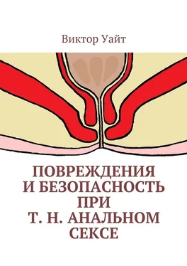 Виктор Уайт Повреждения и безопасность при т. н. анальном сексе обложка книги