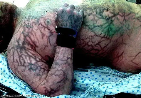 Вскрытие покажет Записки увлеченного судмедэксперта со всеми иллюстрациями 16 - фото 17