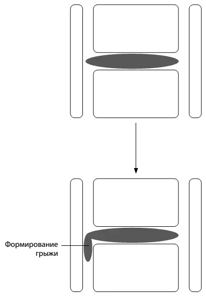 1 Позвоночник это не только костный столб но еще и мышечный корсет - фото 6