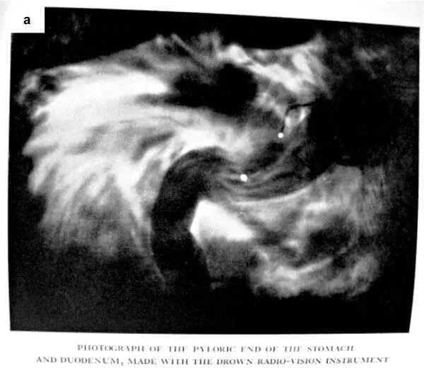 Рис 23 а фотография желудка сделанная Рут Драун Ruth Drown The Science - фото 27