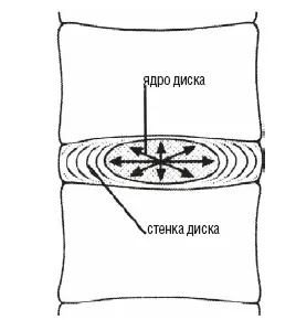 Рис 111Ядро диска функционирует как гидравлический мешок равномерно - фото 19