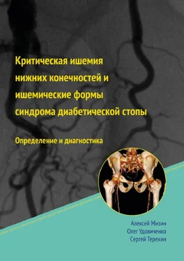 Алексей Мизин Критическая ишемия нижних конечностей и ишемические формы синдрома диабетической стопы обложка книги