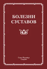 Коллектив авторов - Болезни суставов