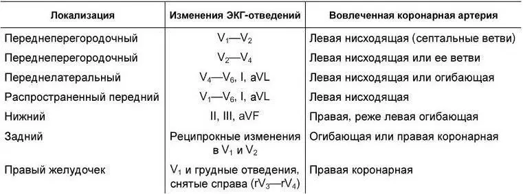При наличии нарушений ритма и проводимости на ЭКГ выявляются соответствующие - фото 18