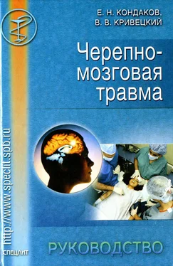 Валерий Кривецкий Черепно-мозговая травма. Руководство обложка книги
