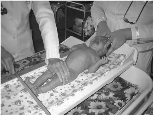 Рис 9 Измерение длины тела ребенка первого года жизни Измерение длины тела - фото 11