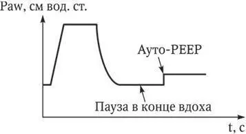 Рис 30 Определение аутоРЕЕР по кривой Pawt в процессе ИВЛ путем создания - фото 34