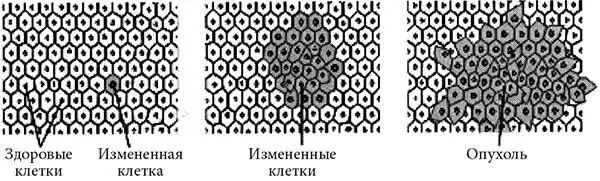 Рис 1Различные стадии патологических изменений молочной железы Это - фото 1