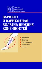 Ирина Старосветская - Варикоз и варикозная болезнь нижних конечностей