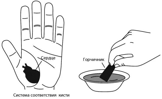 РИС 21 Постановка горчичника на зону соответствия сердцу Кстати ваш любимый - фото 21