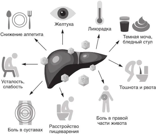 Рис 26 Проявления и симптомы гепатита А Приходится врачам отличать этот - фото 35