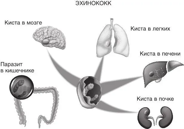 Рис 45 Места обитания эхинококка и расположения кист паразита Эхинококки - фото 66