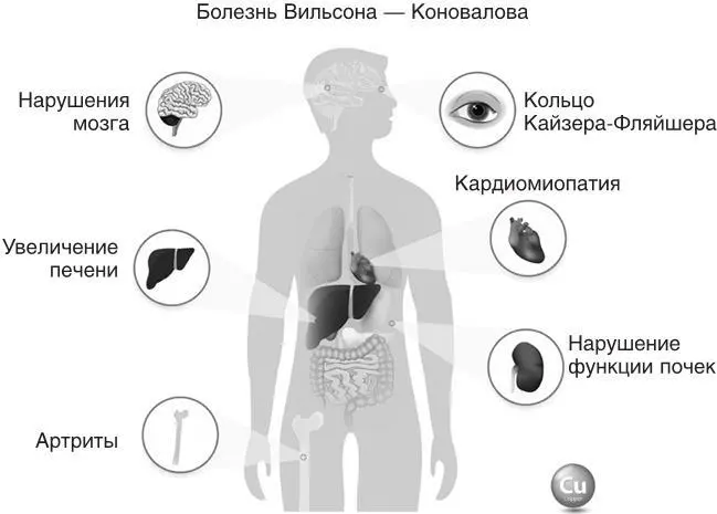 Рис 53 Проявления и симптомы накопления меди Чтобы обнаружить избыток меди и - фото 77
