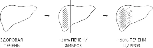 Рис 55 Этапы ухудшения состояния печени Алкоголь является абсолютным лидером - фото 81